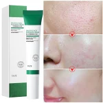 Crema Antiacne/acido Salicilico - Imagen 3