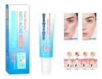Crema Anti-acne Kiss Beauty 25
