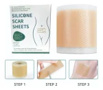 CINTA SILICON REPARACIÓN CICATRIZ - Imagen 2