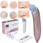 Extractor De Espinillas Limpiador De Poros - Imagen 6