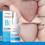 Serum acido Hialuronico Y Vitamina B5 - Imagen 4