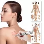 Acupuntura Electrica Electroestimulacion - Imagen 2