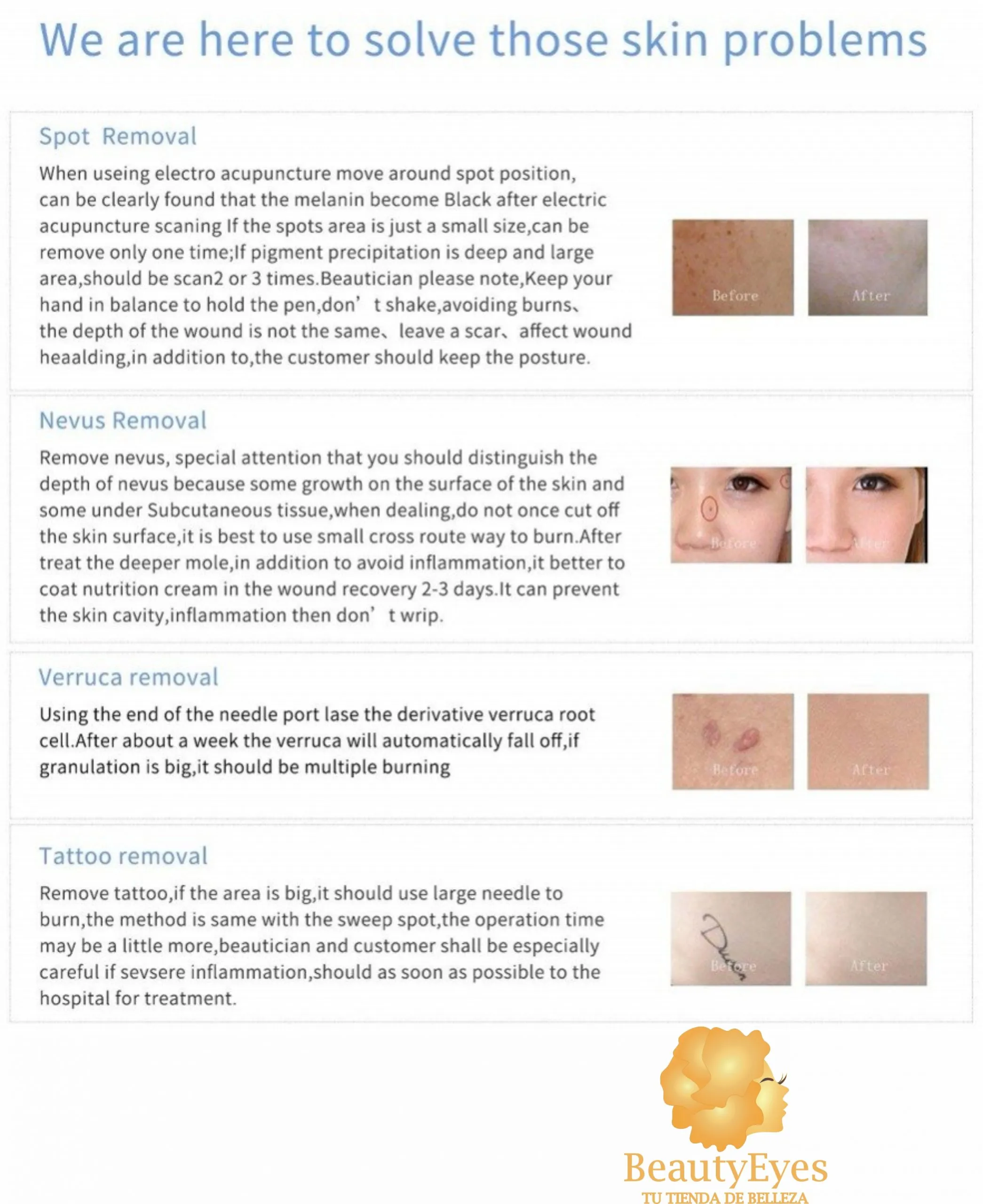 Cauterizador de 3 Niveles Recargable - Imagen 2