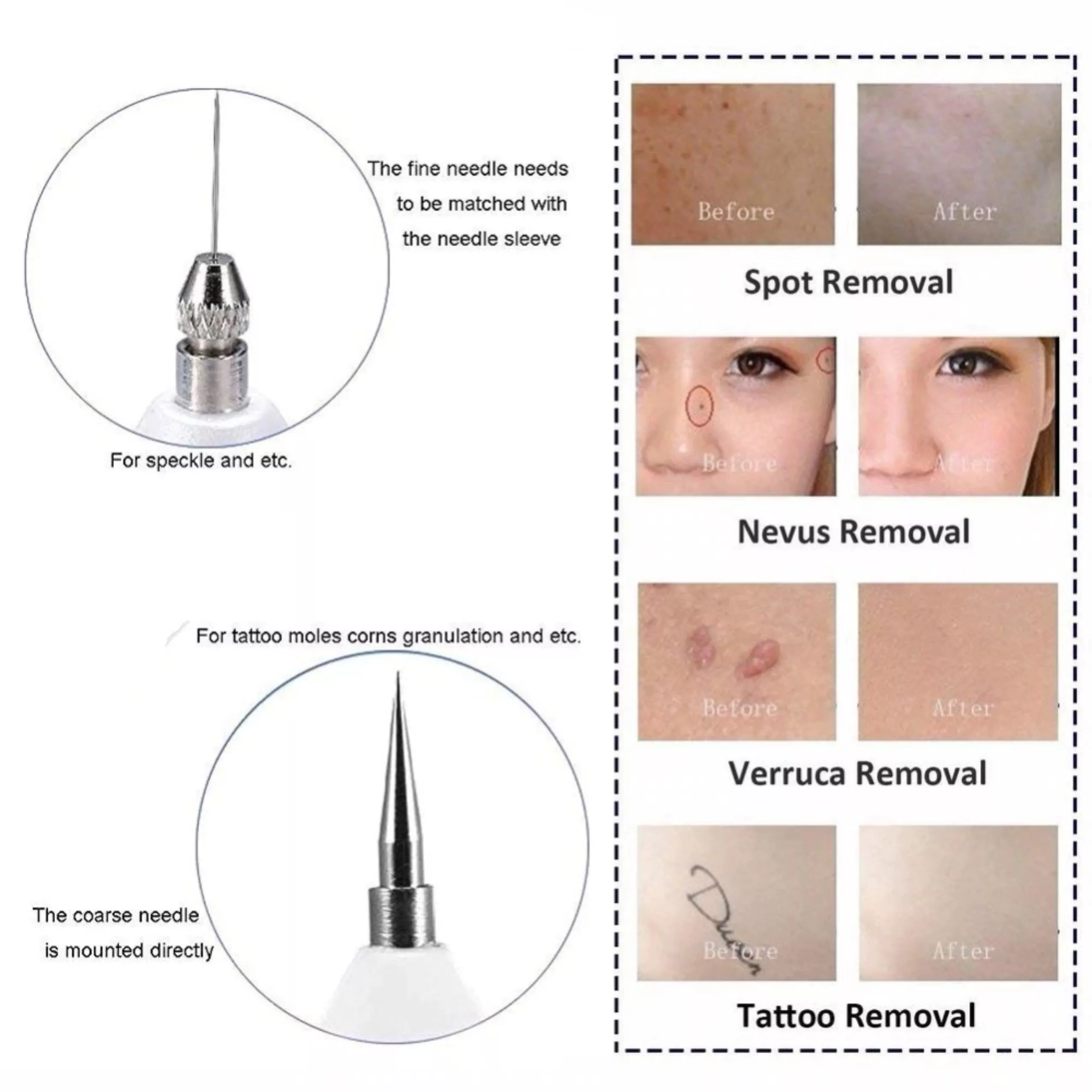 Cauterizador de 3 Niveles Recargable - Imagen 5