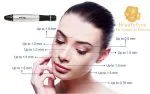 Dermapen Dr Pen A1 de cable - Imagen 6