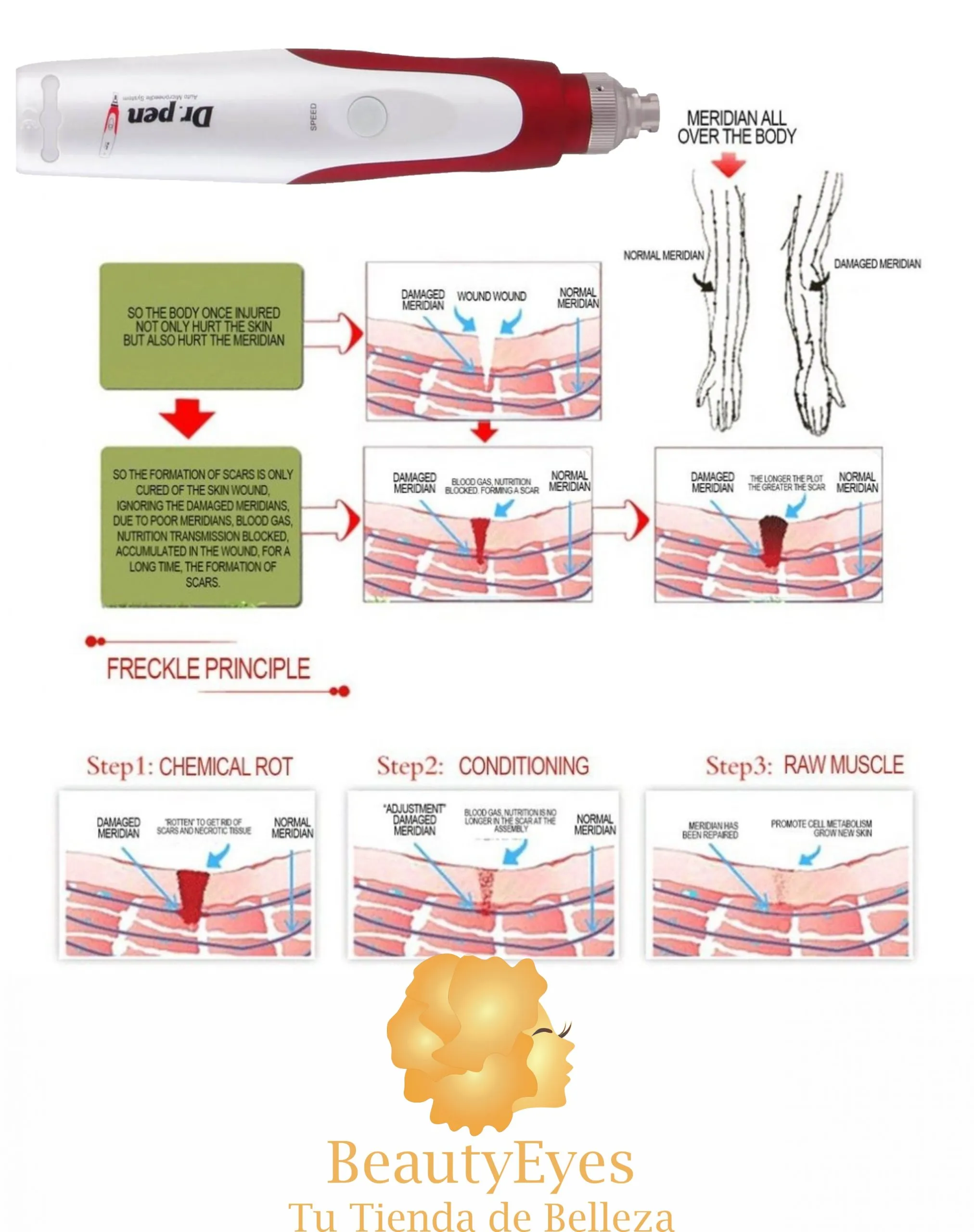 Dermapen Dr Pen N2 Ultima Recargable Inalambrico - Imagen 4