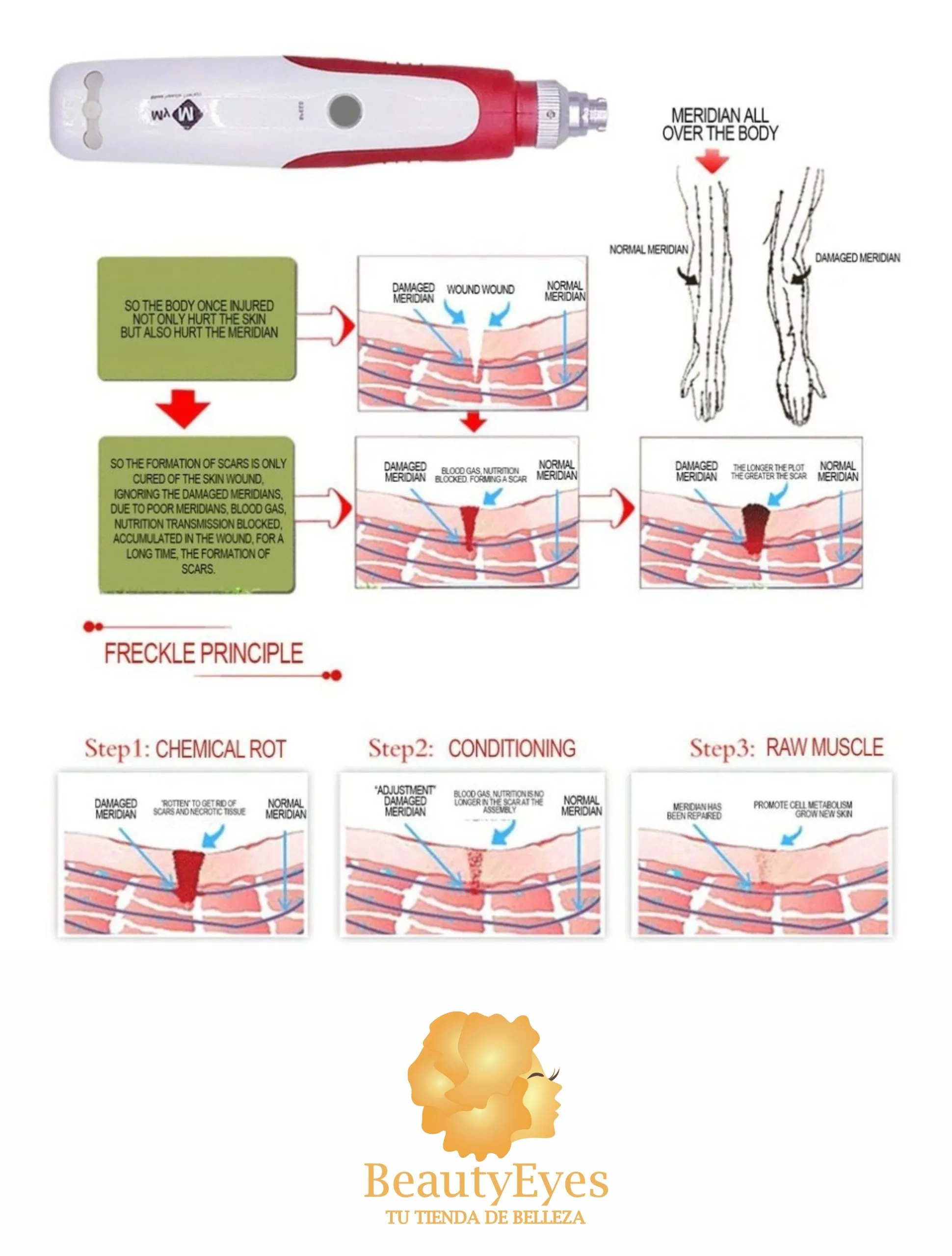 EQUIPO_DERMAPEM_MYM_5 Dermapen N2 Tratamiento Facial BB Glow - Imagen 3