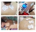 Electrodos Parches para Gimnasia Pasiva x 4 - Imagen 3