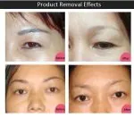 Kit removedor de pigmento Faylaili para micropigmentacion - Imagen 4