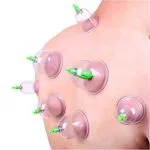 Masajeador Ventosa Chinas Vacumterapia Set De 12 Copas - Imagen 3